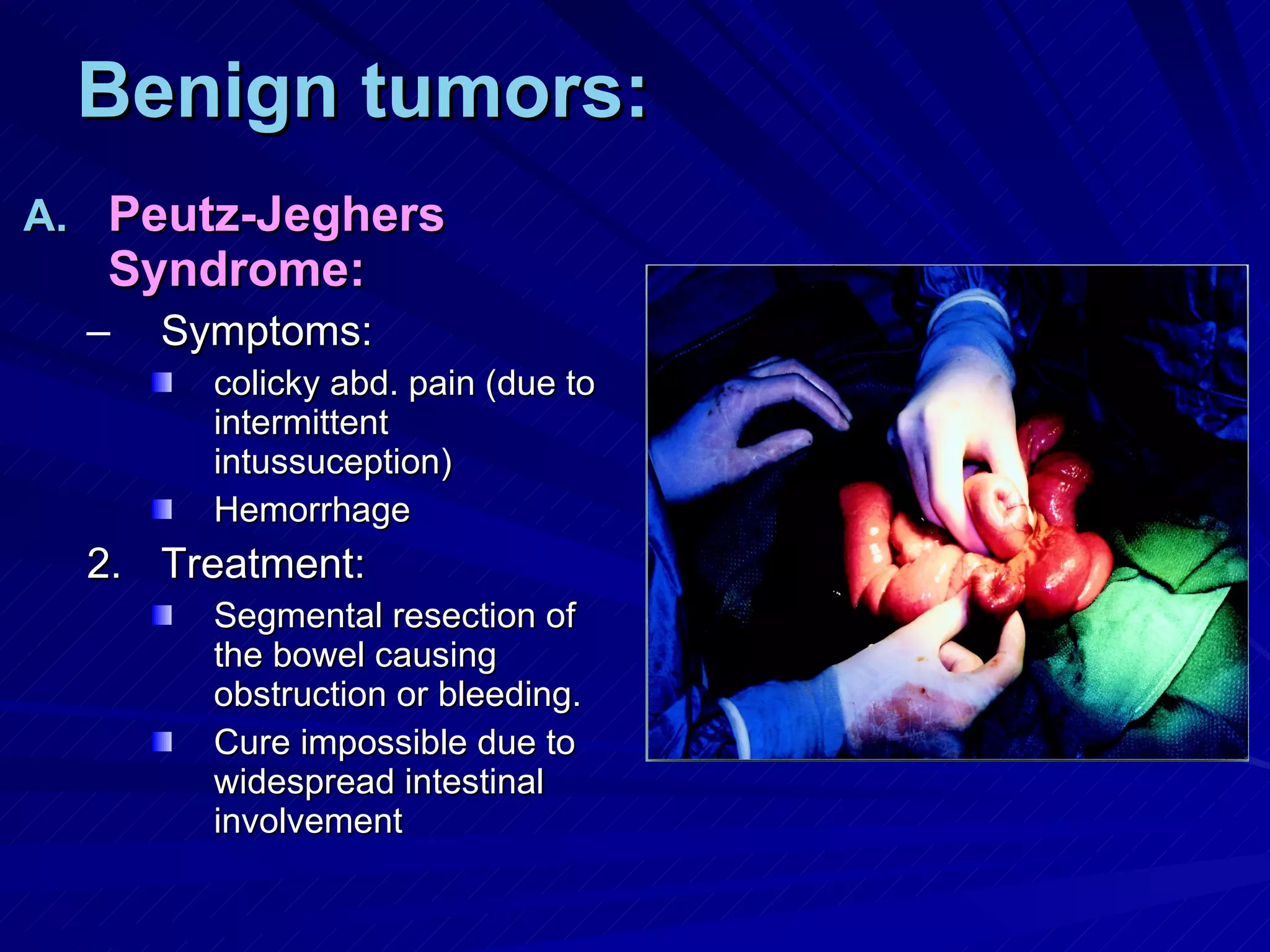 Benign tumors: Peutz-Jeghers Syndrome: Symptoms: colicky abd. pain (due to intermittent intussuception) Hemorrhage Treatment: Segmental resection of the bowel causing obstruction or bleeding. Cure impossible due to widespread intestinal involvement 