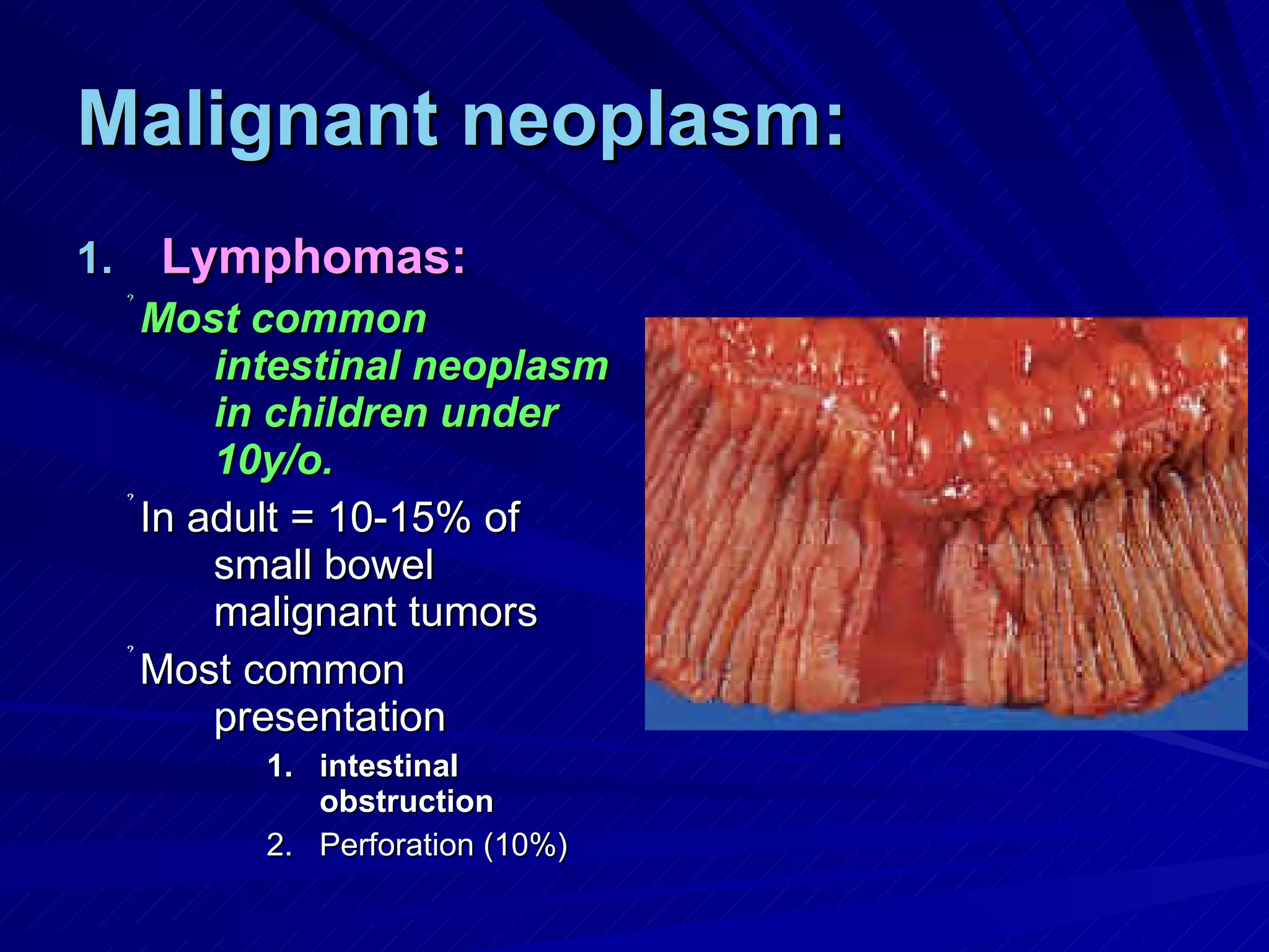 Malignant neoplasm: Lymphomas: Most common intestinal neoplasm in children under 10y/o. In adult = 10-15% of small bowel malignant tumors Most common presentation intestinal obstruction Perforation (10%) 