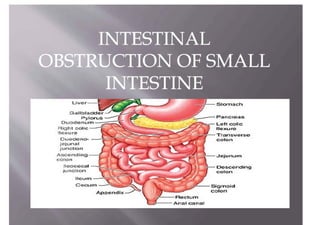 Small Intestine Obstruction. a medical Presentation--11.pdf