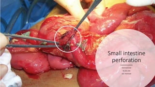 Small intestine
perforation
SWATILEKHADAS
RN, BSN, MSN
ASST. PROFESSOR
 