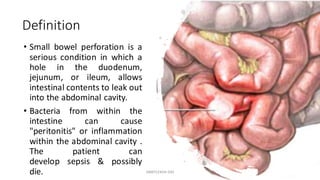 Small intestine perforation | PDF
