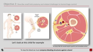 small_limb_hemorrhage_control_course_011724.pptx