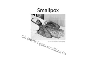 Smallpox
 