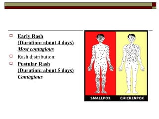    Early Rash
    (Duration: about 4 days)
    Most contagious
   Rash distribution:
   Pustular Rash
    (Duration: about 5 days)
    Contagious
 