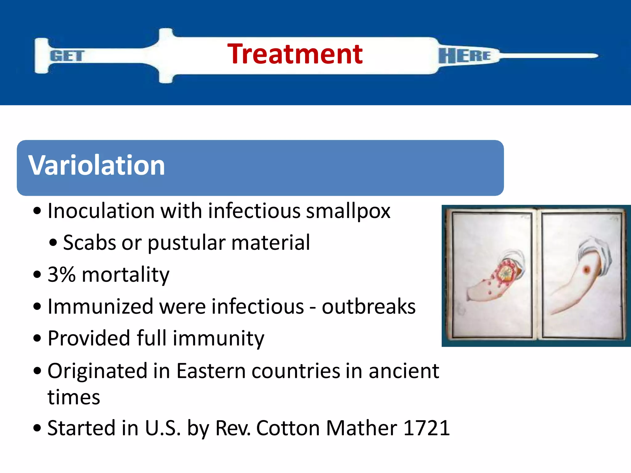 Variolation
• Inoculation with infectious smallpox
• Scabs or pustular material
• 3% mortality
• Immunized were infectious - outbreaks
• Provided full immunity
• Originated in Eastern countries in ancient
times
• Started in U.S. by Rev. Cotton Mather 1721
Treatment
 