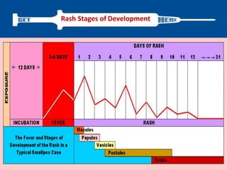Rash Stages of Development
 