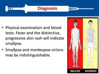 • Physical examination and blood
tests. Fever and the distinctive,
progressive skin rash will indicate
smallpox.
• Smallpox and monkeypox virions
may be indistinguishable.
Diagnosis
 