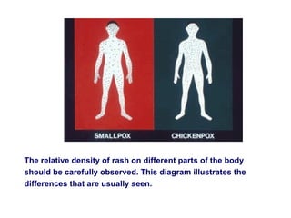 Dense Vs Diffuse Rash Smallpox ppt for nursing Students GNM & B.Sc