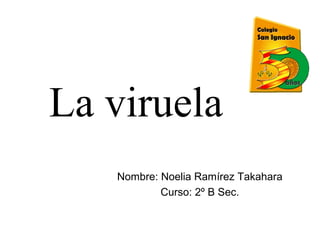 La viruela
Nombre: Noelia Ramírez Takahara
Curso: 2º B Sec.

 