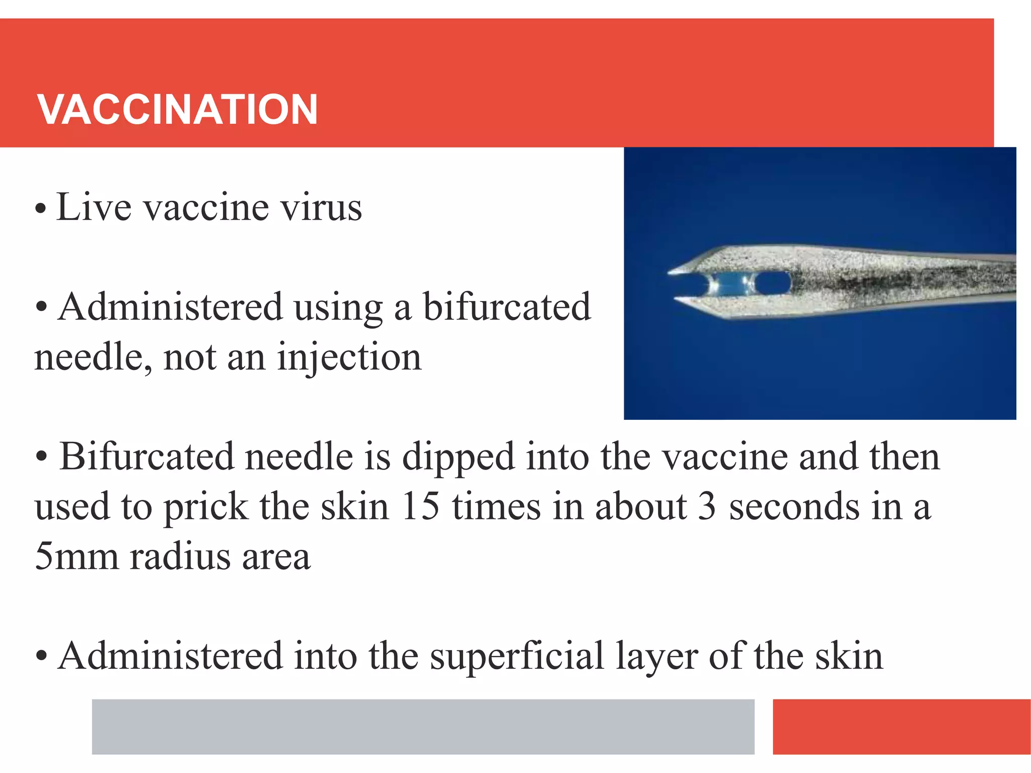 VACCINATION
• Live vaccine virus
• Administered using a bifurcated
needle, not an injection
• Bifurcated needle is dipped into the vaccine and then
used to prick the skin 15 times in about 3 seconds in a
5mm radius area
• Administered into the superficial layer of the skin
 