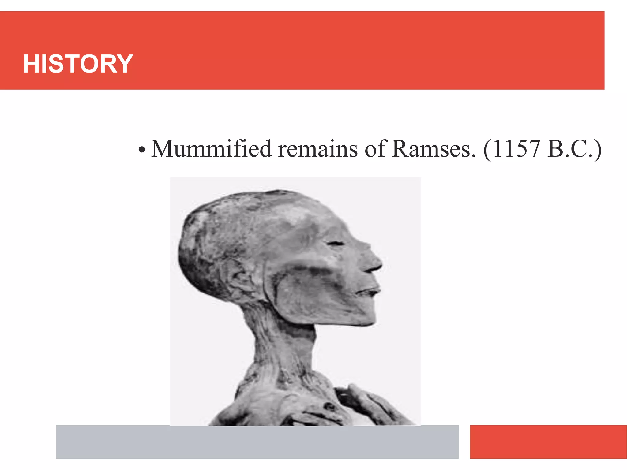 HISTORY
• Mummified remains of Ramses. (1157 B.C.)
 