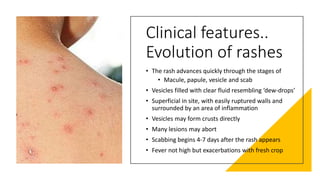 Diffuse Dew Drop Rash Small pox & chichen pox | PPTX