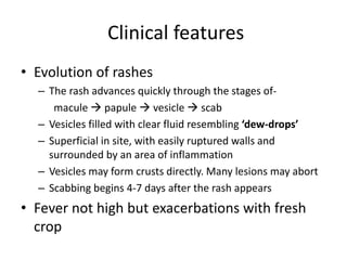 Clinical features
• Evolution of rashes
– The rash advances quickly through the stages of-
macule  papule  vesicle  scab
– Vesicles filled with clear fluid resembling ‘dew-drops’
– Superficial in site, with easily ruptured walls and
surrounded by an area of inflammation
– Vesicles may form crusts directly. Many lesions may abort
– Scabbing begins 4-7 days after the rash appears
• Fever not high but exacerbations with fresh
crop
 