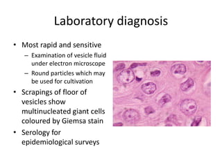 Laboratory diagnosis
• Most rapid and sensitive
– Examination of vesicle fluid
under electron microscope
– Round particles which may
be used for cultivation
• Scrapings of floor of
vesicles show
multinucleated giant cells
coloured by Giemsa stain
• Serology for
epidemiological surveys
 