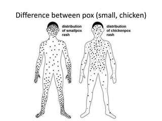 Difference between pox (small, chicken)
 