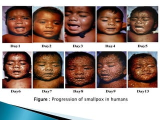 Smallpox Infection Process smallpoxdisease-121027140032-phpapp02.pdf