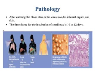 Smallpox Infection Process Smallpox disease | PPTX
