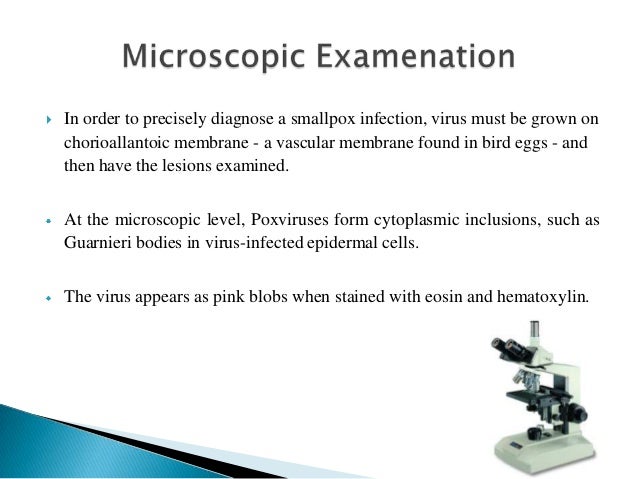 Smallpox disease