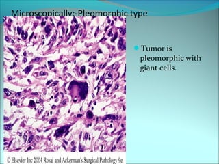 Microscopically:-Pleomorphic type
Tumor is
pleomorphic with
giant cells.
 