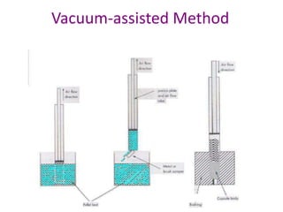 Vacuum-assisted Method 
 