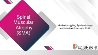 Spinal
Muscular
Atrophy
(SMA)
Market Insights, Epidemiology
and Market Forecast- 2028
 