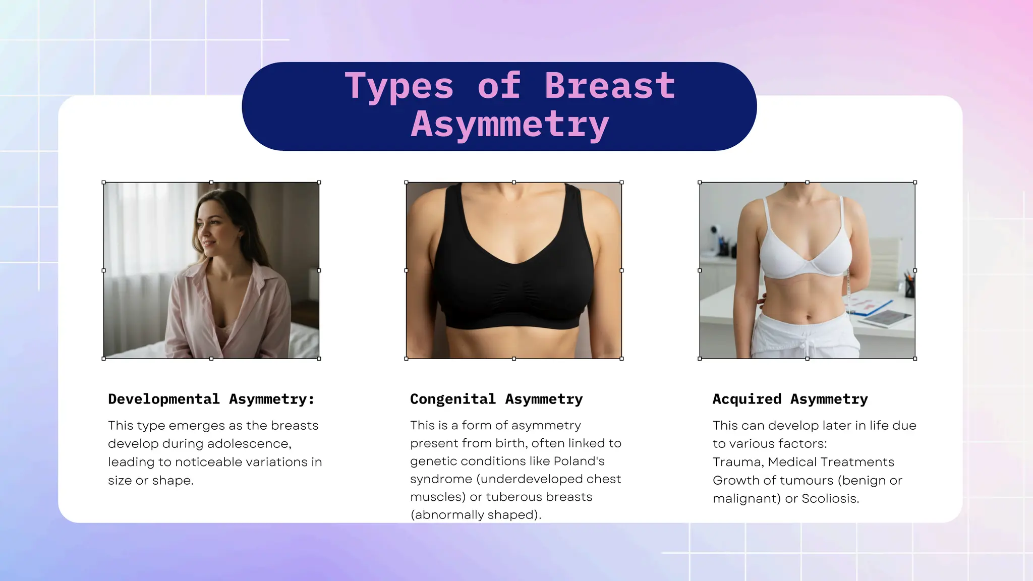 Types of Breast
Asymmetry
This type emerges as the breasts
develop during adolescence,
leading to noticeable variations in
size or shape.
This is a form of asymmetry
present from birth, often linked to
genetic conditions like Poland's
syndrome (underdeveloped chest
muscles) or tuberous breasts
(abnormally shaped).
This can develop later in life due
to various factors:
Trauma, Medical Treatments
Growth of tumours (benign or
malignant) or Scoliosis.
Developmental Asymmetry: Congenital Asymmetry Acquired Asymmetry
 