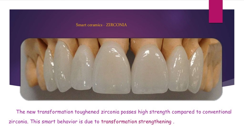 Smart dental materials