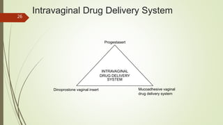 Intravaginal Drug Delivery System
INTRAVAGINAL
DRUG DELIVERY
SYSTEM
Progestasert
Dinoprostone vaginal insert Mucoadhesive vaginal
drug delivery system
26
 