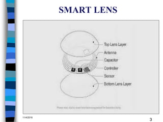 SMART LENS
11/4/2016
3
 