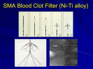 SMA Blood Clot Filter (Ni-Ti alloy)
 
