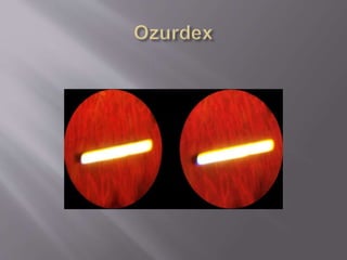 Smartphone ophthalmic imaging