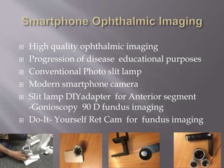  High quality ophthalmic imaging
Progression of disease educational purposes
Conventional Photo slit lamp
Modern smartphone camera
Slit lamp DIYadapter for Anterior segment
-Gonioscopy 90 D fundus imaging
Do-It- Yourself Ret Cam for fundus imaging