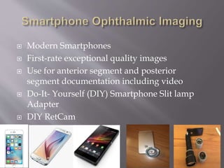  Modern Smartphones
First-rate exceptional quality images
Use for anterior segment and posterior
segment documentation including video
Do-It- Yourself (DIY) Smartphone Slit lamp
Adapter
DIY RetCam