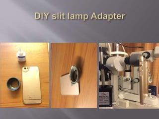 Smartphone ophthalmic imaging