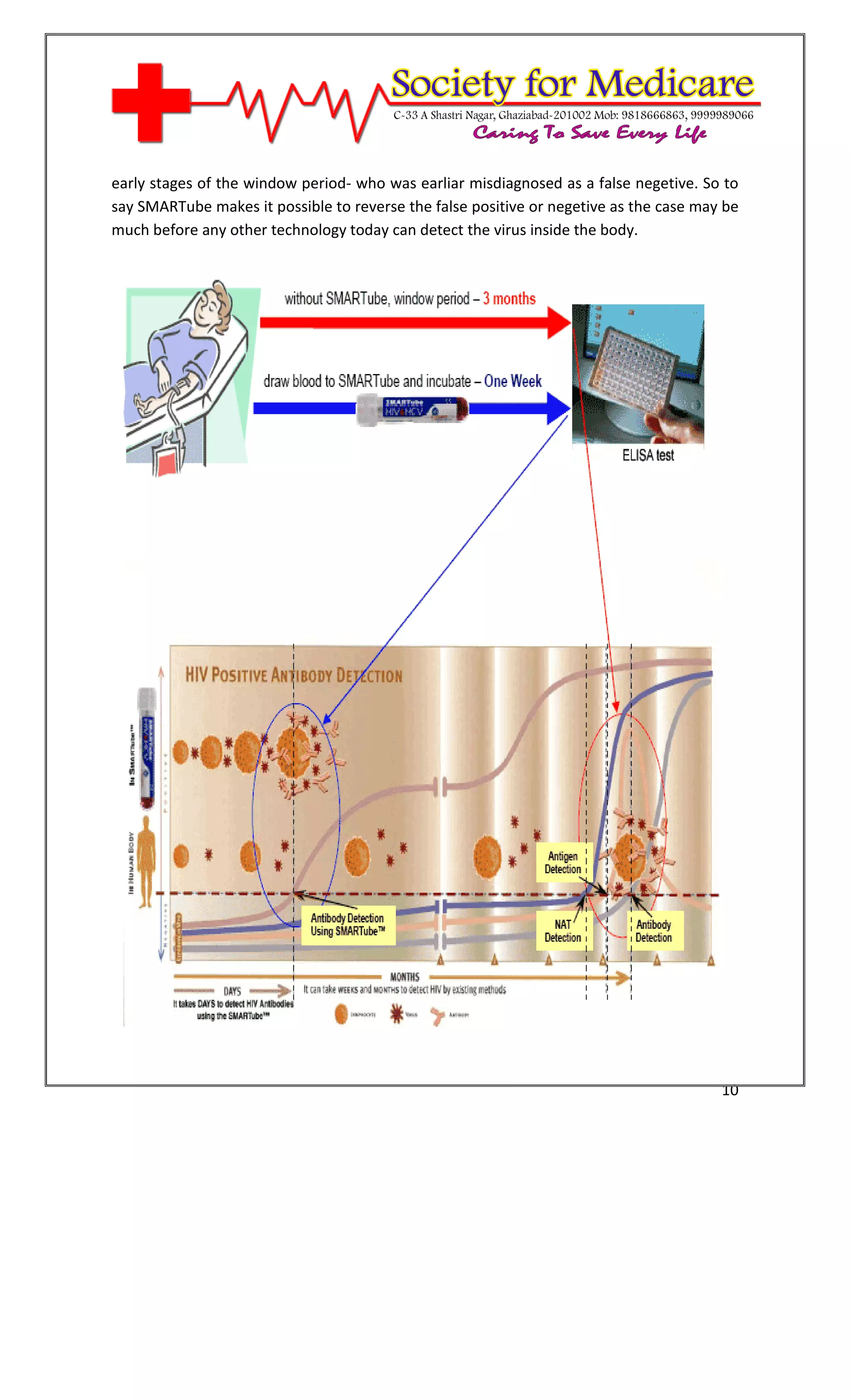 [Type text]




early stages of the window period- who was earliar misdiagnosed as a false negetive. So to
say SMARTube makes it possible to reverse the false positive or negetive as the case may be
much before any other technology today can detect the virus inside the body.




                                                                                        10
 