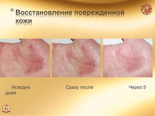 *
Исходно Сразу после Через 5
дней
 