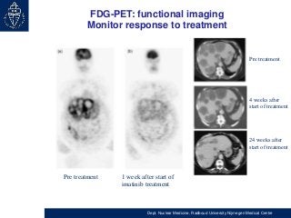 FDG-PET: functional imaging
Monitor response to treatment

Pre treatment

4 weeks after
start of treatment

24 weeks after...