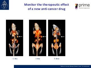 Monitor the therapeutic effect
of a new anti-cancer drug

- 1 day

1 day

3 days

Radboud University Nijmegen Medical Cent...