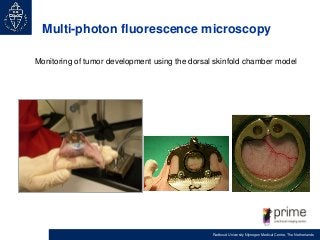Multi-photon fluorescence microscopy
Monitoring of tumor development using the dorsal skinfold chamber model

Radboud Univ...