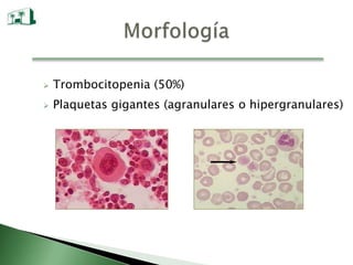 Apoptosis incrementada