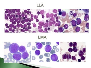 WHO Prognostic Scoring System (WPSS)