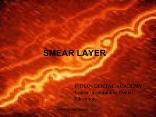SMEAR LAYER
INDIAN DENTAL ACADEMY
Leader in continuing Dental
Education
www.indiandentalacademy.com
 