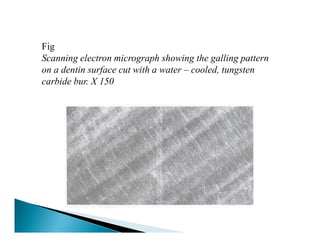 Smear Layer Modifications Smear layer | PDF
