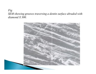Smear Layer Modifications Smear layer | PDF