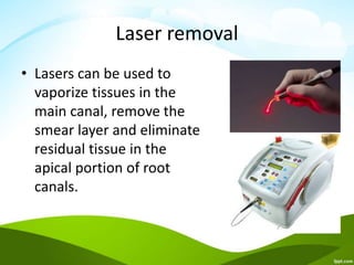 Laser removal
• Lasers can be used to
vaporize tissues in the
main canal, remove the
smear layer and eliminate
residual tissue in the
apical portion of root
canals.
 