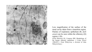 Low magnification of the surface of the
nasal cavity taken from a transition region.
Patches of respiratory epithelium (R; dark
areas) can be seen within the olfactory (O)
region (×28).
(From Morrison EE, Costanzo RM. Morphology of
the human olfactory epithelium. J Comp Neurol
1990;297:1. From Wiley-Liss, a division of John
Wiley & Sons.)
 