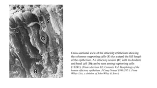 Cross-sectional view of the olfactory epithelium showing
the columnar supporting cells (S) that extend the full length
of the epithelium. An olfactory neuron (O) with its dendrite
and basal cell (B) can be seen among supporting cells
(×1241). (From Morrison EE, Costanzo RM. Morphology of the
human olfactory epithelium. J Comp Neurol 1990;297:1. From
Wiley- Liss, a division of John Wiley & Sons.)
 