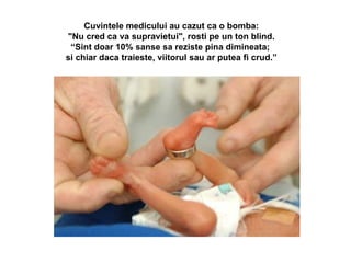 Cuvintele medicului au cazut ca o bomba: "Nu cred ca va supravietui", rosti pe un ton blind. “ Sint doar 10% sanse sa reziste pina dimineata;  si chiar daca traieste, viitorul sau ar putea fi crud.” 