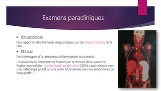 Examens paracliniques
 IRM abdominale
Peut apporter des éléments diagnostiques sur des lésions focales de la
rate.
 PET scan
Peut témoigner d’un processus inflammatoire ou tumoral.
L'évaluation de l'intensité de fixation par la mesure de la valeur de
fixation normalisée: standardized uptake value (SUV), peut orienter vers
une pathologie plutôt qu'une autre (SUV élevée dans les lymphomes de
haut grade... ).
 