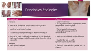 Principales étiologies
Hémopathies Chercher
• Malignes:
 Maladie de Hodgkin et lymphomes non hodgkiniens
 Leucémie lymphoïde chronique
 Leucémies aiguës myéloblastiques et lymphoblastiques
 Syndromes myéloprolifératifs (maladie de Vaquez, leucémie
myéloïde chronique, myélofibrose primitive, thrombocytémie
essentielle)
• Bénignes:
les hémolyses chroniques
• Syndrome tumoral
• NFS: Hyperleucocytose, myélémie au frottis,
polyglobulie, thrombocytose..
• Phénotypage lymphocytaire
• Électrophorèse de protides et
immunofixation
• Myélogramme, biopsie ostéomédullaire
• Mutation bcr-abl ou Jak2 ...
Splénomégalie volumineuse
• Électrophorèse de l'hémoglobine, test de
Coombs
 